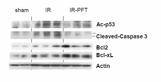 PFT increases SIRT1 induction, promotes anti-apoptotic functions