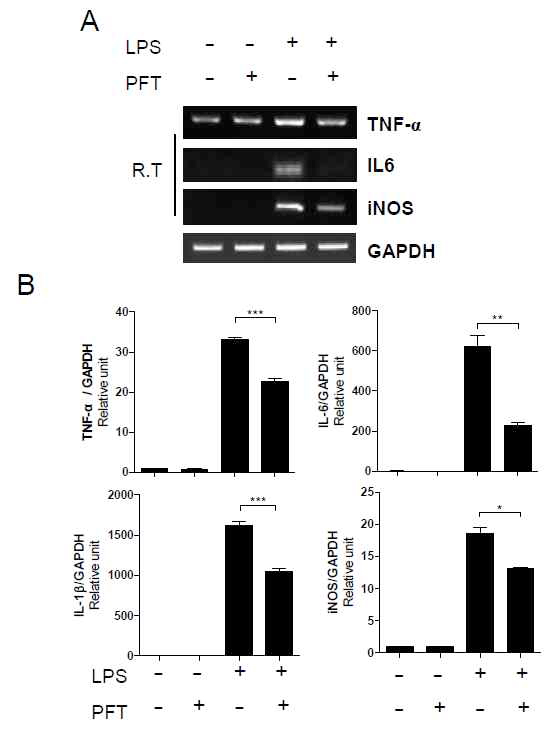 PFT reduces inflammatory response in macrophages