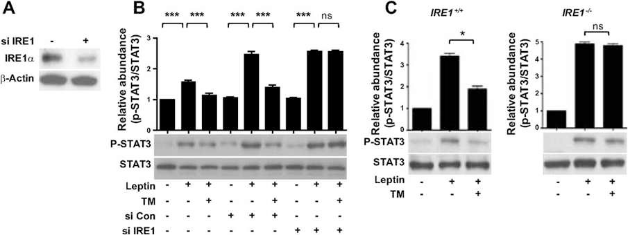 IRE1 is involved in ER stress-induced leptin resistance in SK-N-AS-Ob-Rb Cells