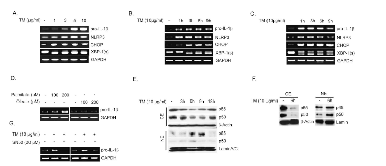 ER stress induces the expression of pro-IL1b mRNA via the activation of NF-kB