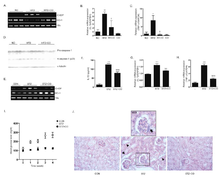 CO inhalation inhibits inflammasome formation in High-fat diet mice and STZ-induced diabetic model