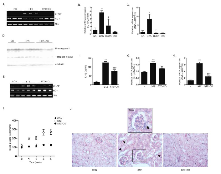 CO inhalation inhibits inflammasome formation in High-fat diet mice and STZ-induced diabetic model