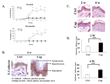 신생 흰쥐에 캡사이신을 주사한 후 가려움증, 피부염을 측정하고 (A), 피부조직 H&E 염색을 통해 hyperplasia와 분화이상 소견을 관찰하였다