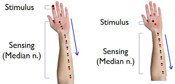 자극부위 및 신경신호 측정 위치