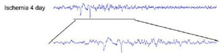 뇌졸중 유발 후 3~4일경 실험군의 해마에서 나타나는 뇌파신호