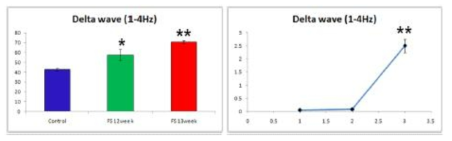 FS 유발 후 나타나는 Delta wave의 변화