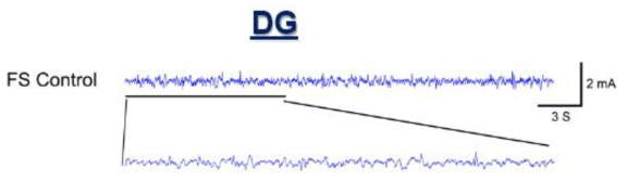 정상대조군의 해마내 DG에서의 뇌파형태