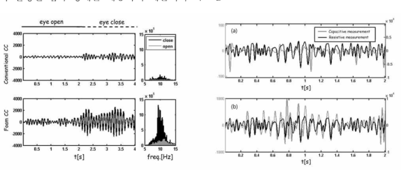 (좌) 기존의 용량성 전극 및 개발된 폼 표면으로 측정된 알파파 비교, (우) Case report: (a)기존의rigid한 표면의 용량성 전극 (b) 개발된 폼 표면의 전극