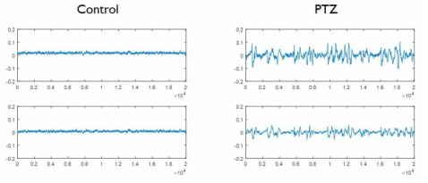 실험군(PTZ)과 대조군(control)의 뇌파 비교