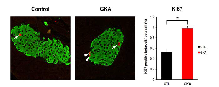 Glucokinase activator 투여 후 Ki67 발현