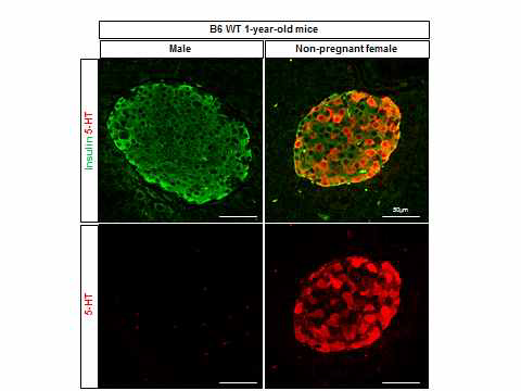 52주령 마우스 암컷(우)과 수컷(좌) 췌도 베타세포에서의 세로토닌 합성