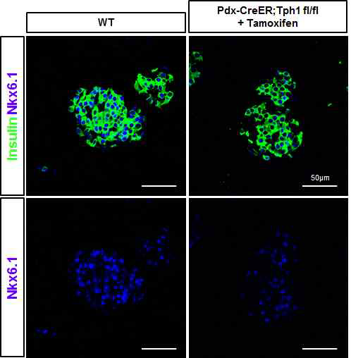 췌장소도에서 인슐린, Nkx6.1 면역형광염색