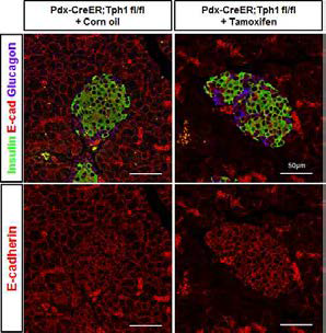췌장소도에서 인슐린, E-cadherin, 글루카곤 면역형광염색