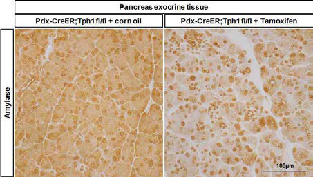 췌장조직에서 amylase 면역염색