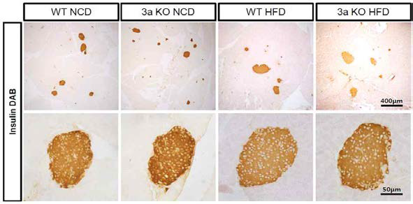 고지방식이 6주 후 인슐린 DAB 염색