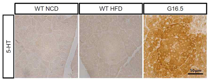 정상식이와 고지방식이 하의 췌장소도에서 세로토닌 염색