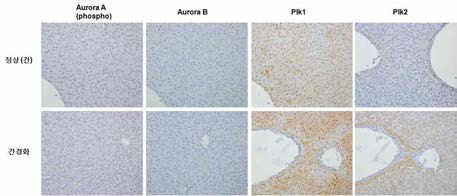 mitotic kinase 의 발현양상 조사