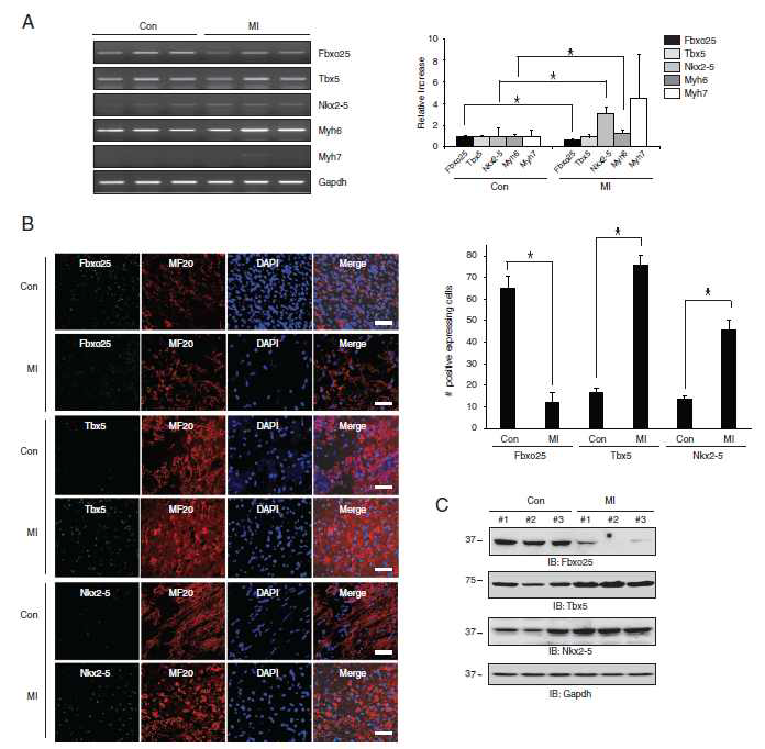 Fbxo25 reduction leads to induction of Tbx5 and Nkx2-5 expressions in injured heart