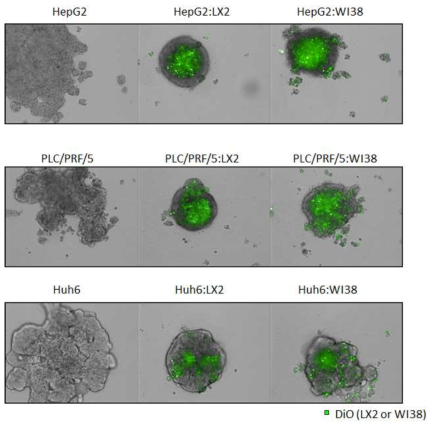 간암세포와 기질세포(Stromal cells)의 혼합배양에 따른 스페로이드의 치밀성 (Compactness) 변화 분석