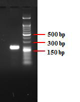 Outer primer를 이용한 Salmonella enteritidis의 genomic DNA의 PCR 증폭 산물에 대한 gel electrophoresis 분석 결과.