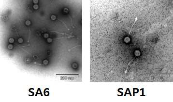 Staph. aureus 를 감염시키는 박테리오페이지의 TEM 이미지.