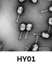 E. coli O157:H7을 감염시키는 박테리오페이지의 TEM 이미지.