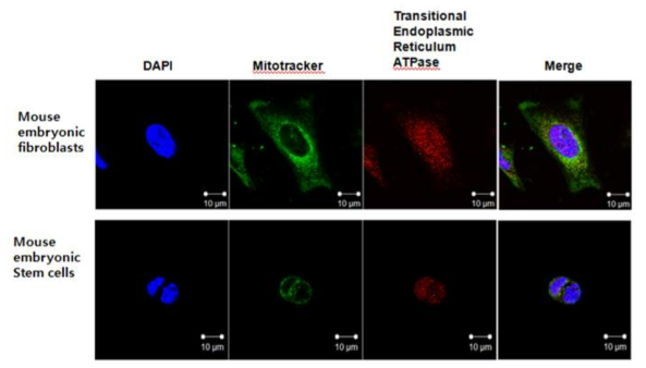 Transitional endoplasmic reticulum ATPase (Vcp) expression in mouse embryonic fibroblast and embryonic stem cell mitochondria.