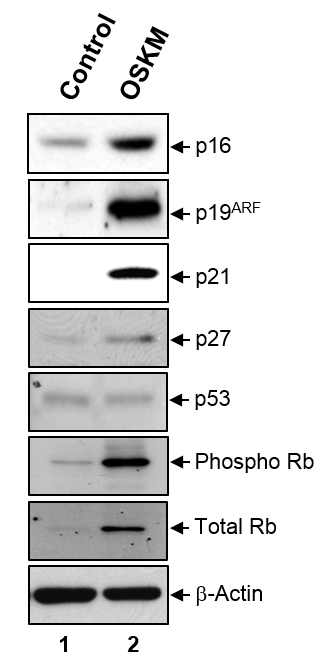 리프로그래밍 초기의 세포주기 조절자인 CDKI와 대표적인 tumor suppressor gene인 p53와 pRb에 대한 발현 패턴 분석.