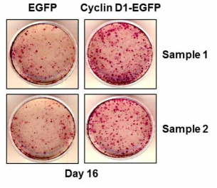 Cyclin D1 overexpression이 리프로그래밍 에 미치는 영향 분석.