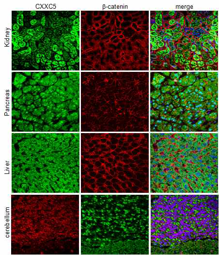 mouse각 장기별 CXXC5의 발현 위치 확인