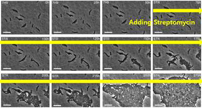 M. tuberculosis A strain 균주의 streptomycin 요구성 생장