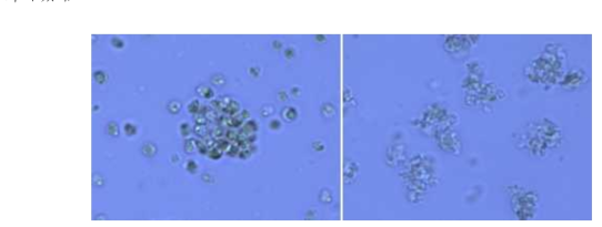 [Bmim][CF3SO3]와 Nannochloropsis oceanica (물함량 65%)를 반응 시켰을 때 현미경 사진.