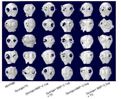 Micro CT(8 weeks)