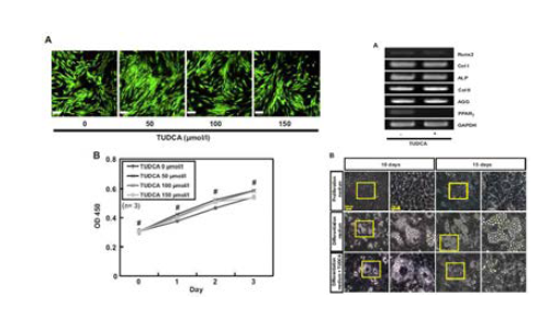 Tudca 처리에 따른 지방줄기세포의 생존 및 지방분화억제 효과 입증.