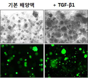 인간유래 지방줄기세포가 개발된 3차원 하이드로젤내에서의 viability