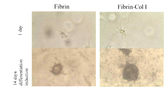 피브린젤에서 1일, 14일 배양된 줄기세포의 형태