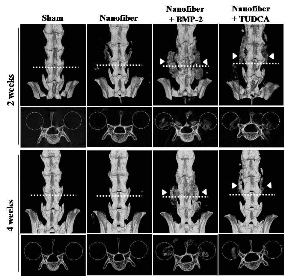 Nanofiber가 이식된 부위의 micro-CT 3차원 이미지