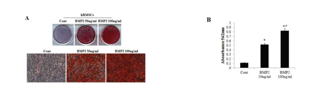 hBMSC의 골분화 과정동안 BMP2의 역할규명