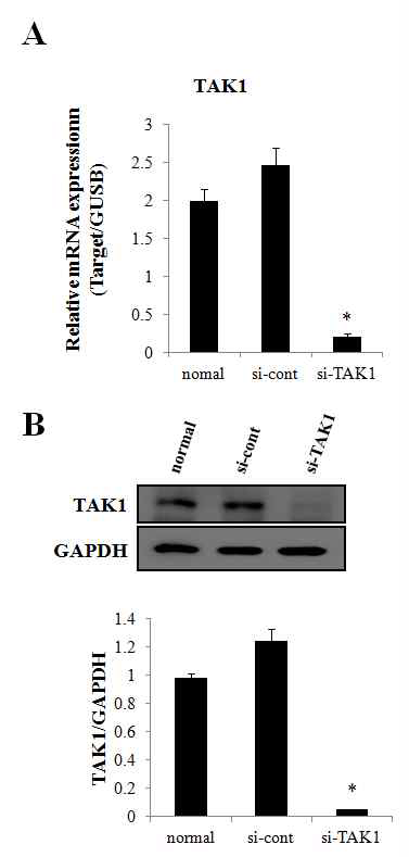 si-TAK1 transfection에 의한 TAK1 발현 억제 효과 입증