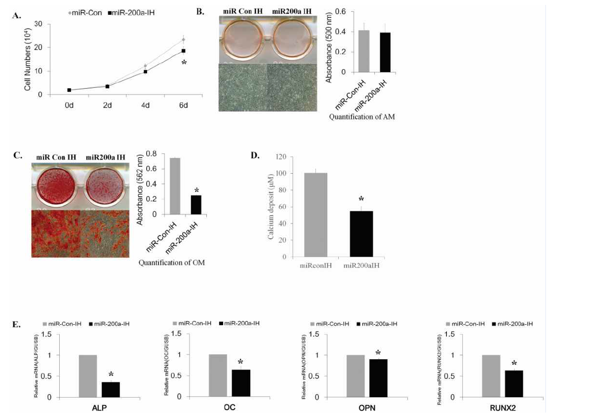 miR-200a 억제에 의한 지방줄기세포의 골분화와 증식 억제효과
