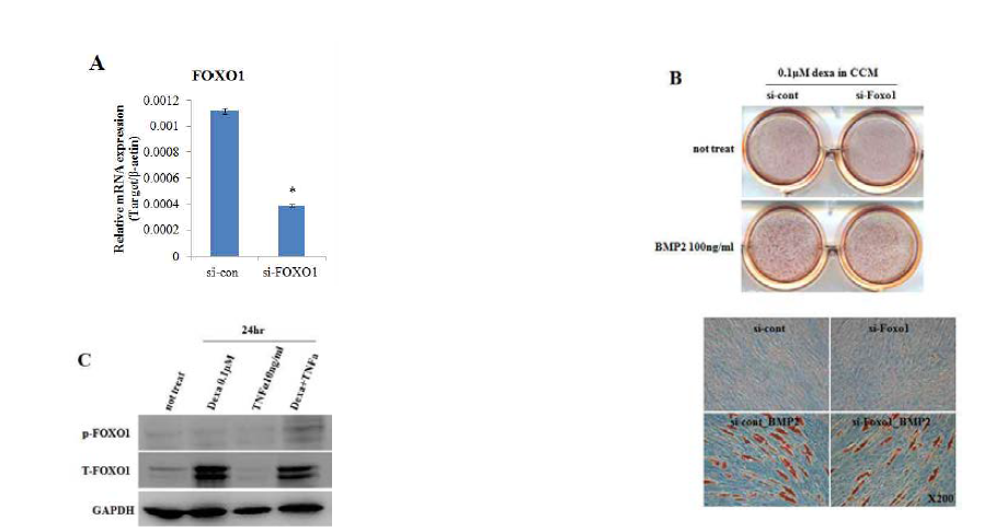 hADSC의 분화에 영향을 주는 BMP2와 TNFα에 의한 상효작용에서 FOXO1의 역할 분석