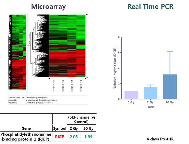 방사선에 따른 방사선 유도 분비체 RKIP의 발현 분석
