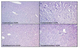 급성독성 시험 최대 농도인 2.000 mg/kg body weight에서의 간과 신장의 조직사진