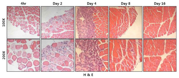 근육 손상 모델에서 손상된 근육과 재생되는 근육의 조직 단면