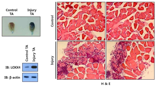 근육 손상에 의한 LOXX4의 단백질 발현 증가