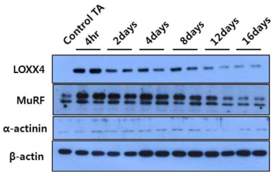 근육 손상 후 재생되는 동안 선별된 1종 유전자, LOXX4의 단백질 발현 양상