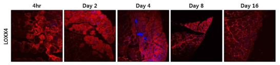 LOXX4의 근육 손상 후 재생 동안 조직 단면에서 단백질 발현 패턴