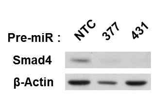 mimic miRNA transfection후 smad4 항체를 이용해 단백질 레벨의 확인