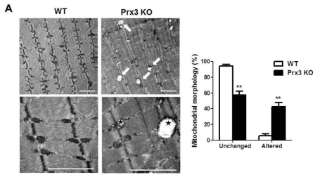 Prx3 KO Soleus 근육조직 전자현미경 분석에서 비정상적인 미토콘드리아 확인