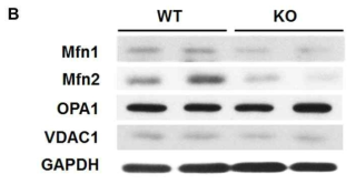 Prx3 KO Soleus 근육조직에서 mitochondria fusion-fission 관련 단백질 확인